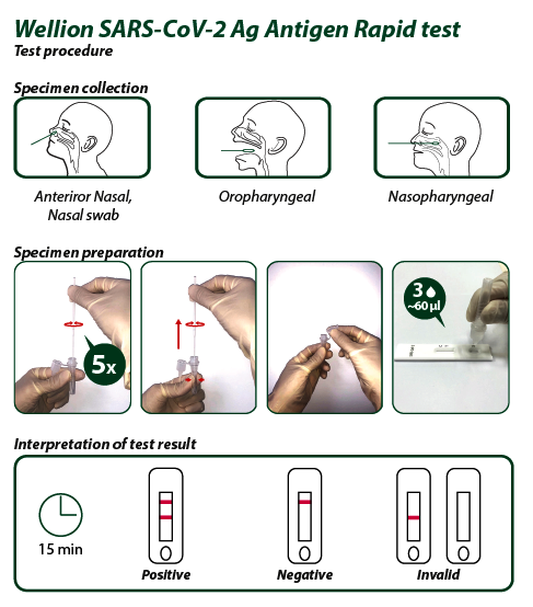 ag test procedure:  (© )